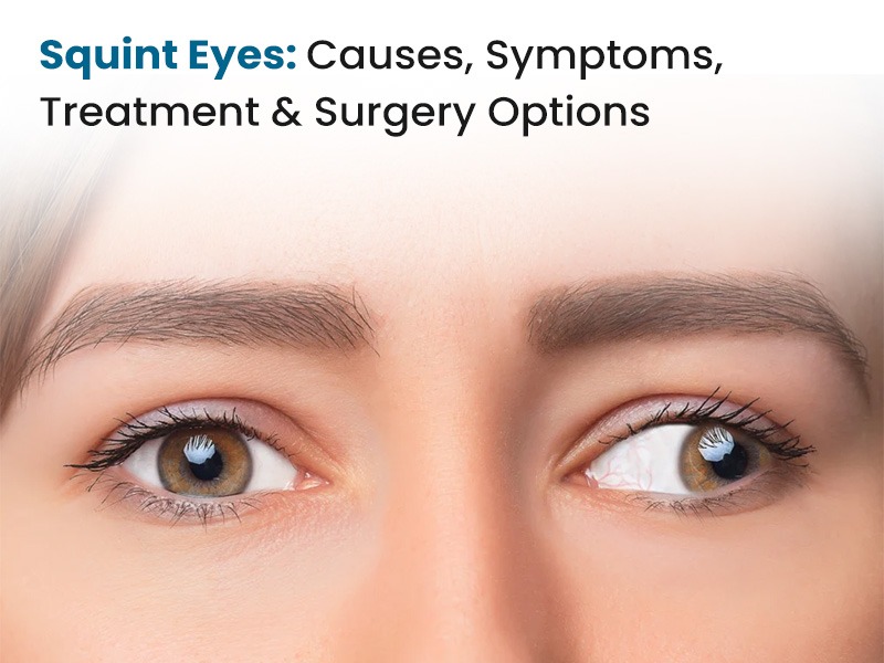 Squint Eyes: Causes, Symptoms, Treatment and Surgery